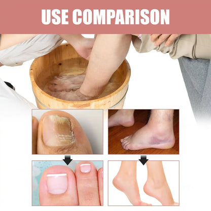 Callus Relief and Soothing Foot Bath Tablets - 5pcs